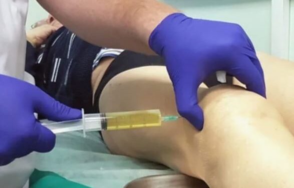 Применение синовиальной жидкости в уколах для лечения суставов
