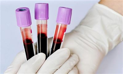 Анализ крови на корь — от 795 рублей в Москве